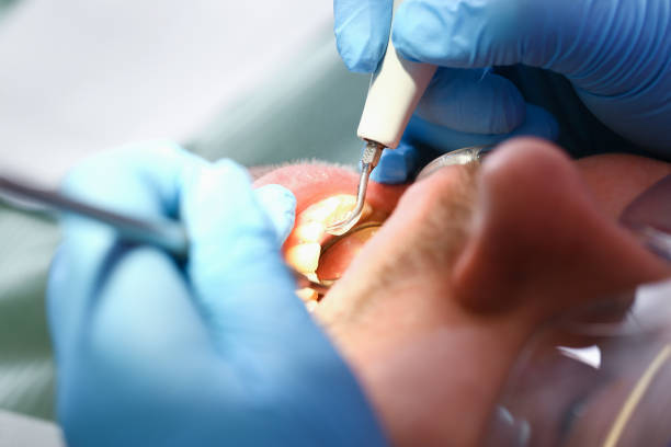 Best Emergency Tooth Extraction in Smithville, TN